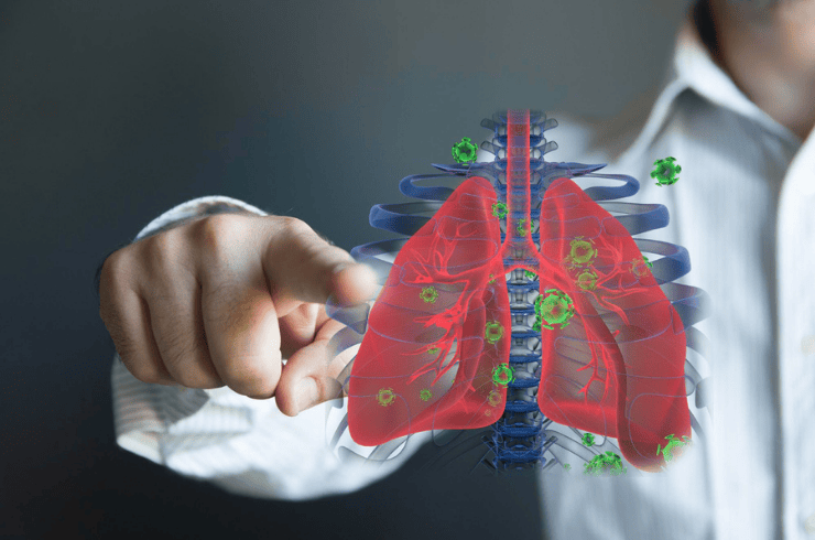 Chronic Obstructive Pulmonary Disease (COPD)