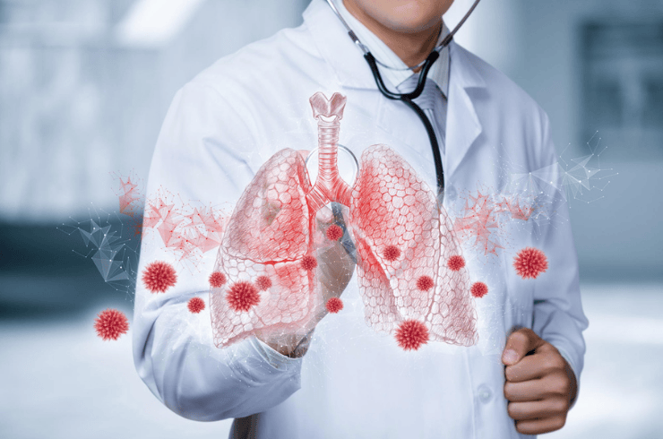 Pulmonary Fibrosis Care